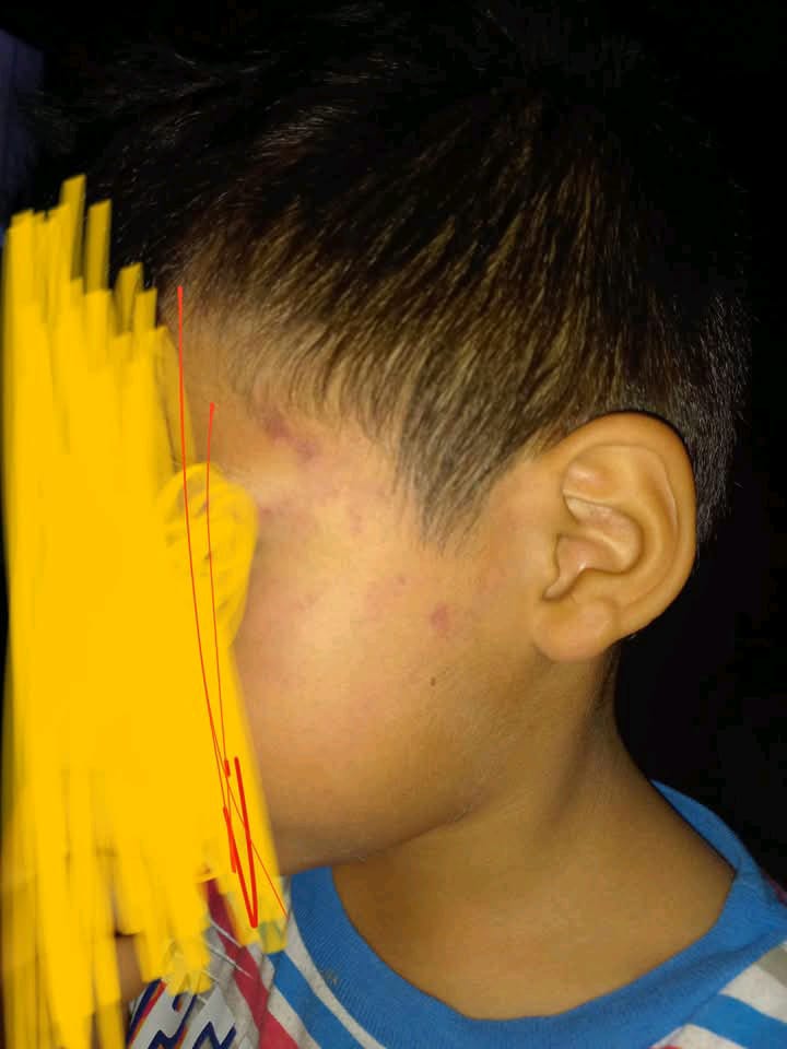 DIF Madero investiga presunto maltrato infantil tras denuncia en redes&nbsp;sociales.